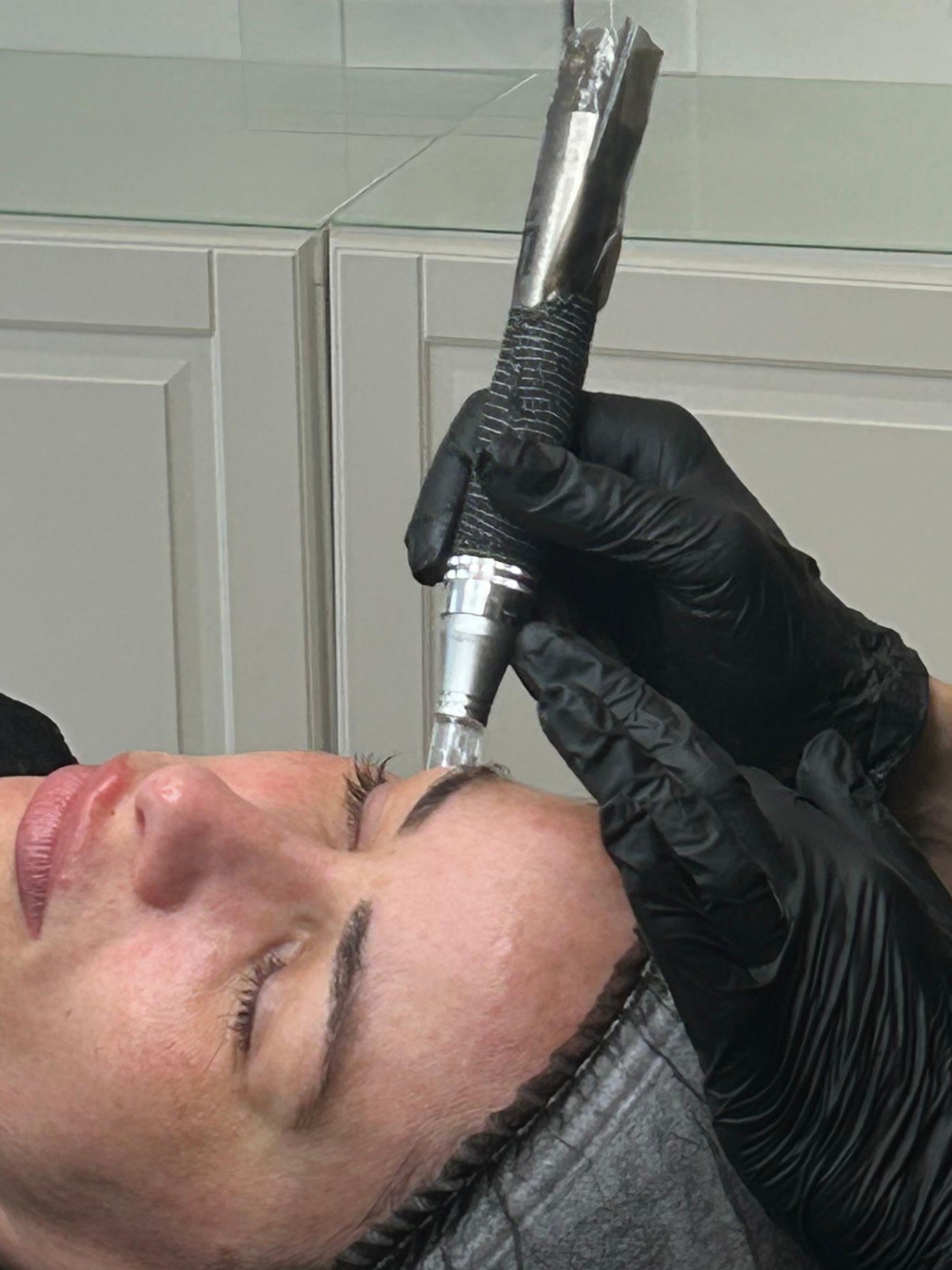 Microneedling und BB Glow